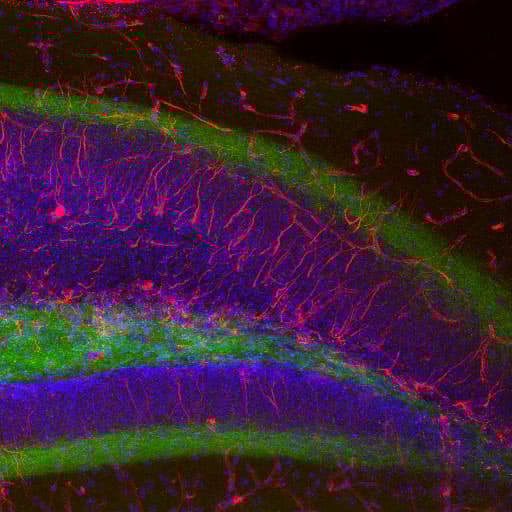 Anti-Nestin antibody(AB134017)