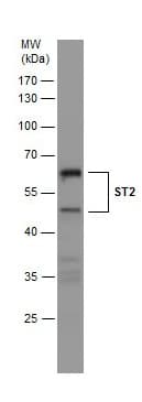 Anti-ST2 antibody(AB228543)