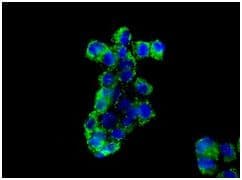 Ak3l1 Antibody Epr7678 Ab131327  Immunocytochemistry Immunofluorescence Img71487