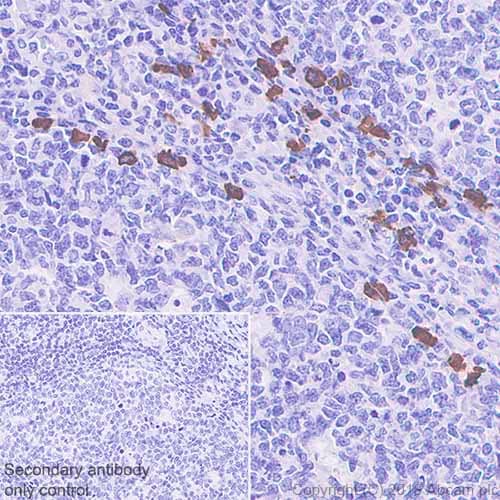 Igg4 Antibody Ep4420 Low Endotoxin Azide Free Ab186921  Immunohistochemistry Formalin Pfa Fixed Paraffin Embedded Sections Img172750