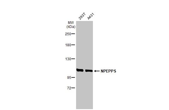 Npepps Antibody Hl1531 Ab308163  Western Blot Img407062