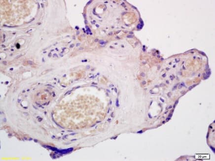 Abcg1 Antibody Ab217023  Immunohistochemistry Formalin Pfa Fixed Paraffin Embedded Sections Img121057