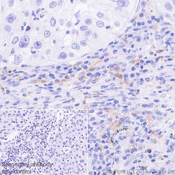 Macrophage Polarization Panel - Human IHC(ab278180)