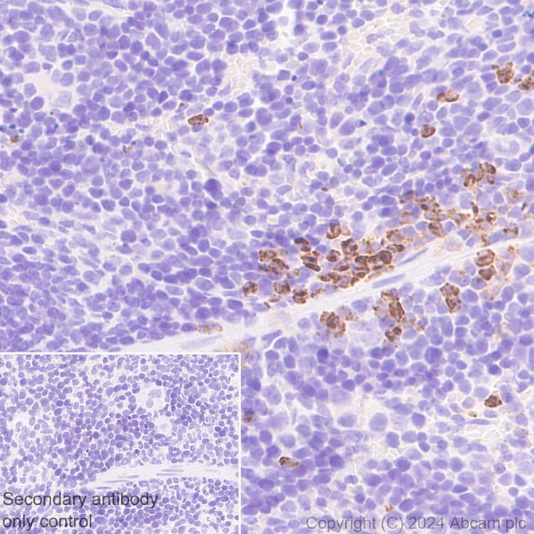 Lox 1 Antibody Epr27871 67 Bsa And Azide Free Ab317690  Immunohistochemistry Formalin Pfa Fixed Paraffin Embedded Sections Img432109