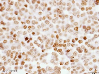 Anti-BANF1/BAF antibody [EPR7668](AB129184)