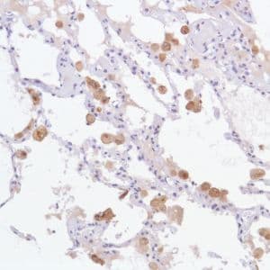 Gpnmb Antibody Sp299 Bsa And Azide Free Ab272016  Immunohistochemistry Formalin Pfa Fixed Paraffin Embedded Sections Img135856