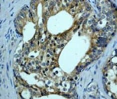 Braf Antibody Ep152y Ab33899  Immunohistochemistry Formalin Pfa Fixed Paraffin Embedded Sections Img8120