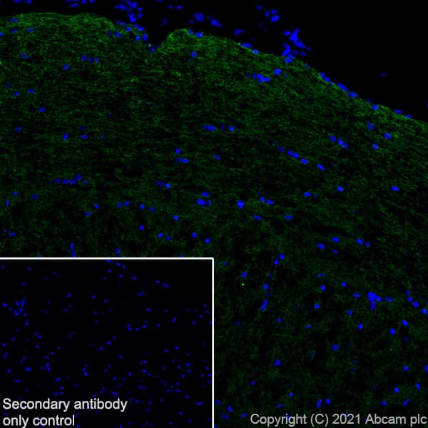 Myelin Plp Antibody Plpc 1 Ab9311  Immunohistochemistry Frozen Sections Img168551