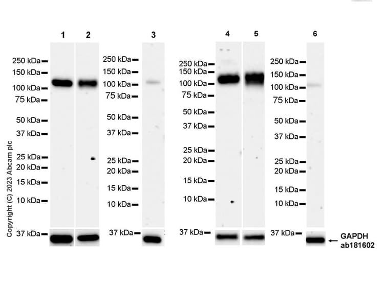 Anti-NFkB Inducing Kinase NIK antibody [EPR26101-23] - BSA and Azide free(AB314147)