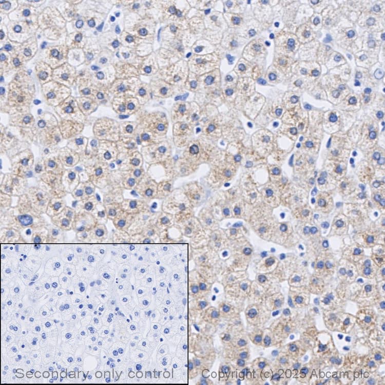 Anti-iNOS antibody [RM1017](AB283655)