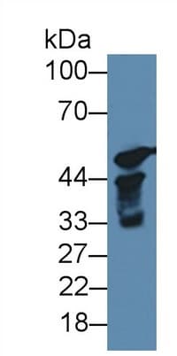 Anti-Cytochrome P450 17A1/CYP17A1 antibody(AB231914)