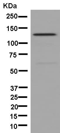 Dhx8 Prp22 Antibody Epr91462 Ab181074  Western Blot Img81465