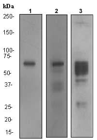 Anti-MMP2 antibody [EPR1184](AB92536)