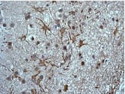 Csn8 Antibody Epr5139 Ab124779  Immunohistochemistry Formalin Pfa Fixed Paraffin Embedded Sections Img117612