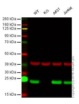 Anti-Peroxiredoxin 1/PAG antibody [EPR5433](AB109498)