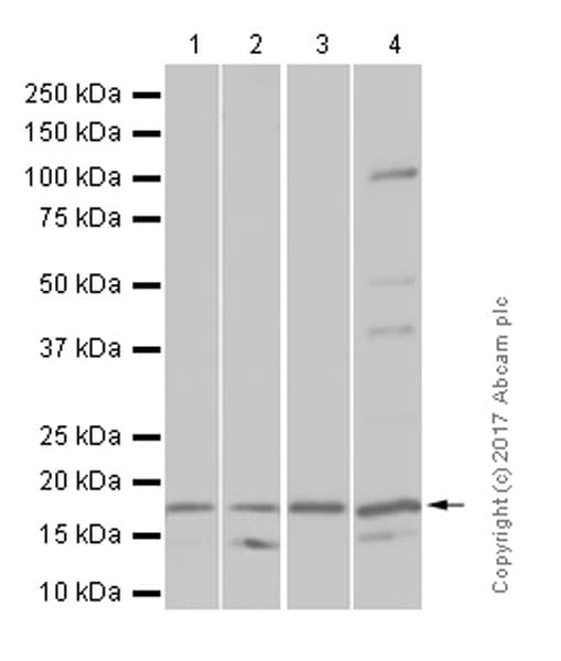 Sdhc Antibody Epr11035b Ab155999  Western Blot Img149618