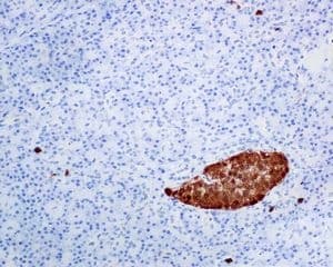 Scgn Secretagogin Antibody Epr7477 Bsa And Azide Free Ab248768  Immunohistochemistry Formalin Pfa Fixed Paraffin Embedded Sections Img114946