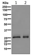 Superoxide Dismutase 3 Ec Sod Antibody Epr10860 Bsa And Azide Free Ab249643  Western Blot Img61175