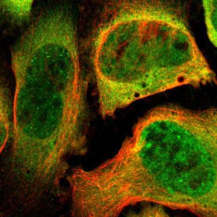 Anti-Proteasome 19S S4/PSMC1 antibody(AB223765)
