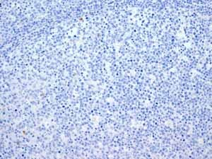 Anti-Myosin light chain 3 antibody [EPR4160] - BSA and Azide free(AB247710)