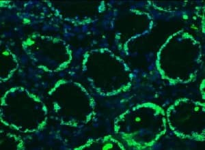 Anti-Lamin B1 antibody [119D5-F1] - Nuclear Envelope Marker(ab8982)