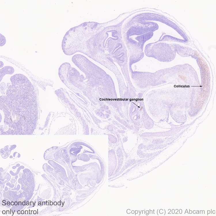 Anti-BRN3A antibody [EPR23257-285](AB245230)