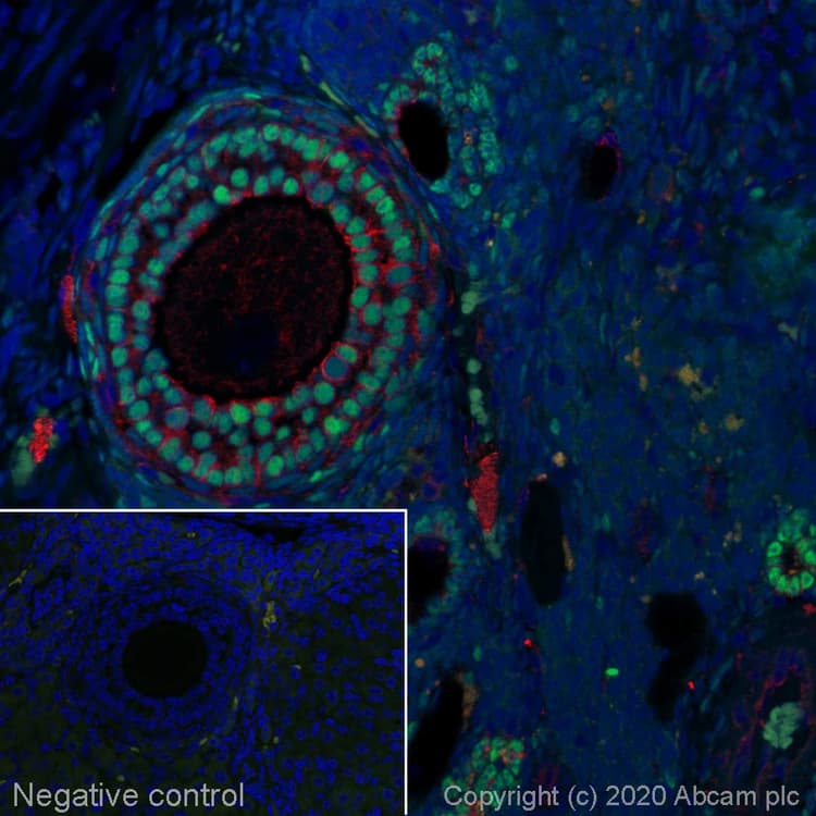 Alexa Fluor® 488 Anti-FOXL2 antibody [EPR23523-68](AB275152)