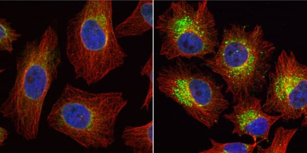 Anti-LC3B antibody - N-terminal(AB229327)