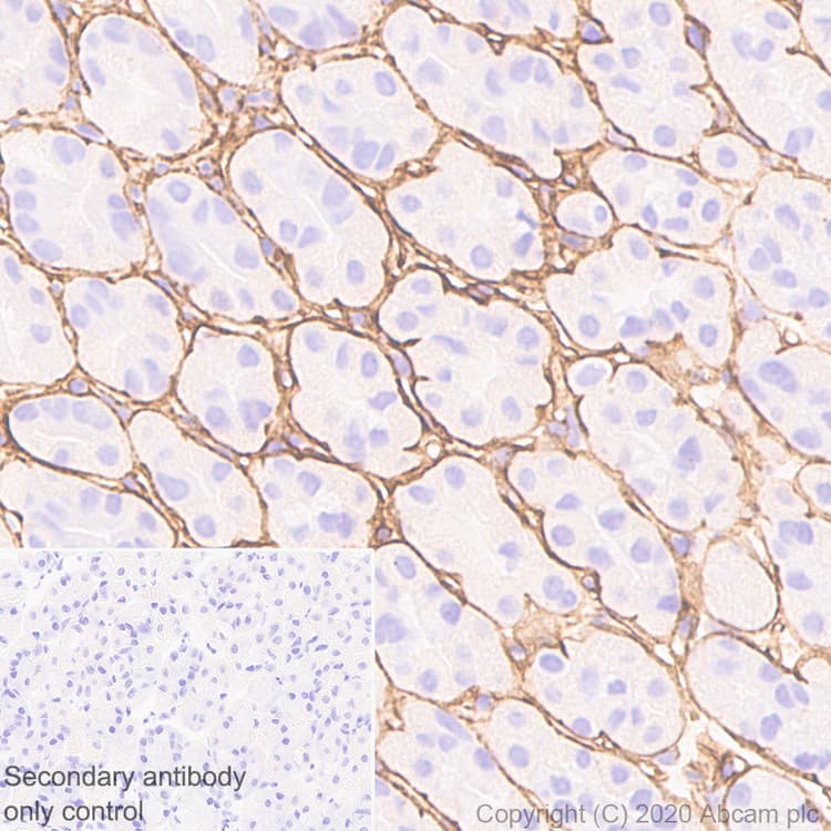 Anti-Collagen I antibody [EPR24331-53](AB270993)
