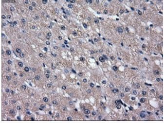 Anti-GLUT5 antibody [OTI20E1](AB279363)