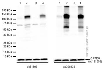 Anti-HIF-1 alpha antibody [EP1215Y](ab51608)