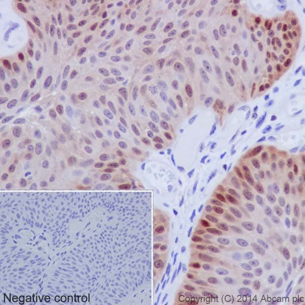 Hsp70 Antibody Epr17677 Ab182844  Immunohistochemistry Formalin Pfa Fixed Paraffin Embedded Sections Img44741