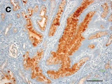 Anti-Mucin 5AC antibody [45M1](ab3649)