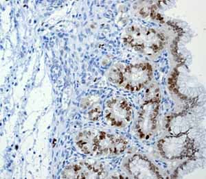 Anti-SOX2 antibody [EPR3131](AB92494)