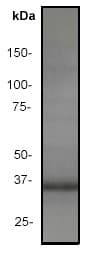 Bcl10 Antibody Ep605y Bsa And Azide Free Ab189218  Western Blot Img144897