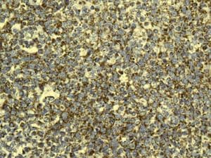 Gc1q R Antibody Epr8870 Ab134926  Immunohistochemistry Formalin Pfa Fixed Paraffin Embedded Sections Img89695