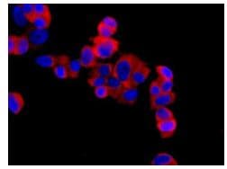 Rpl13 Antibody Epr8828 Bsa And Azide Free Ab248754  Immunocytochemistry Immunofluorescence Img13050