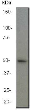 Anti-GFAP antibody [EP672Y](AB33922)