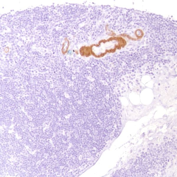 Anti-Calponin 1 antibody [SP180] - C-terminal(AB227660)