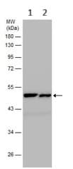 Abat Gaba T Antibody Ab152134  Western Blot Img452168