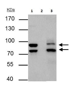 Mdm2 Antibody Chip Grade Ab226939  Immunoprecipitation Img49942