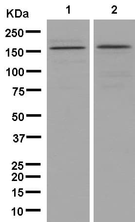 Anti-KDM5B / PLU1 / Jarid1B antibody [EPR12704](AB181089)