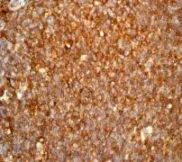 Anti-HLA A antibody [EP1395Y](AB52922)