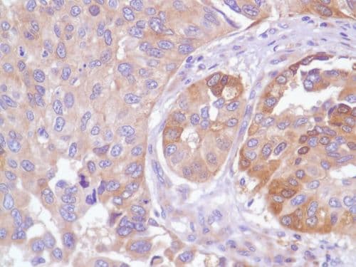 Egfr Antibody Sp84 Bsa And Azide Free Ab238803  Immunohistochemistry Formalin Pfa Fixed Paraffin Embedded Sections Img136656