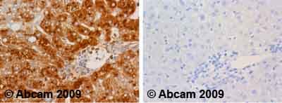 Anti-Human Serum Albumin antibody(AB2406)