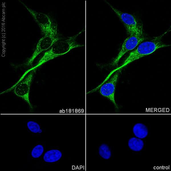 Synaptic Marker (Synaptophysin, Synapsin1, PSD95, VAMP2) Antibody Sampler Panel - Human, Mouse(AB263463)
