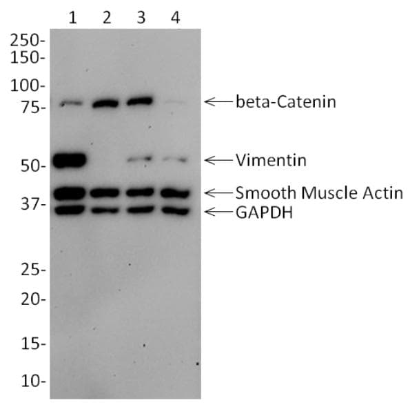 Epithelial-Mesenchymal Transition (Beta Catenin, Vimentin) Western Blot Cocktail(AB157392)