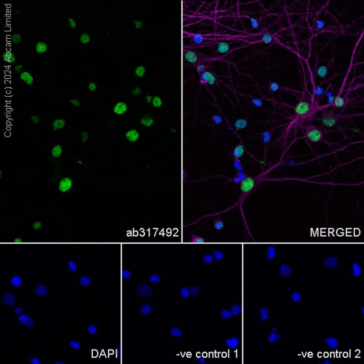 Anti-BRN3A + BRN3B + BRN3C antibody [EPR26313-54](AB317492)
