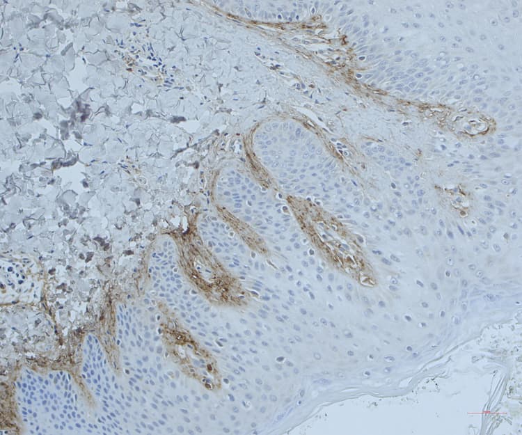 Anti-Periostin antibody(AB14041)