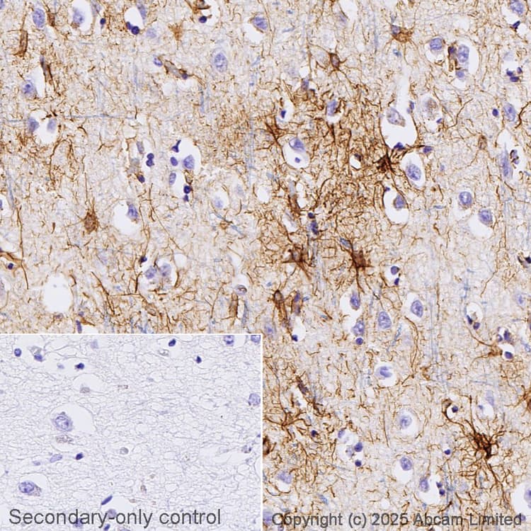 Anti-GFAP antibody [2A5](AB4648)